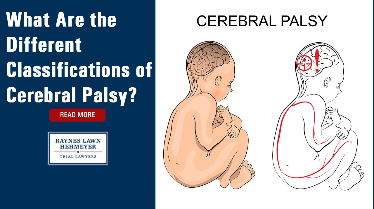 palsy causes