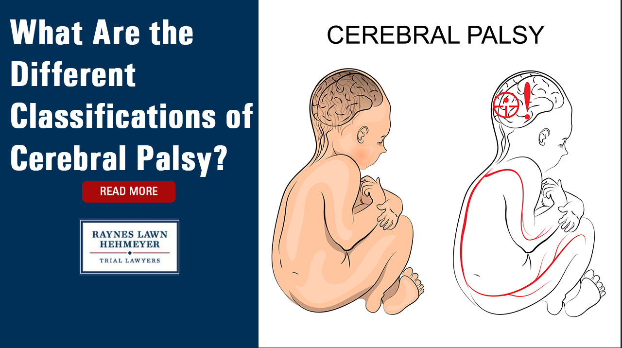 What Are The Different Classifications Of Cerebral Palsy 