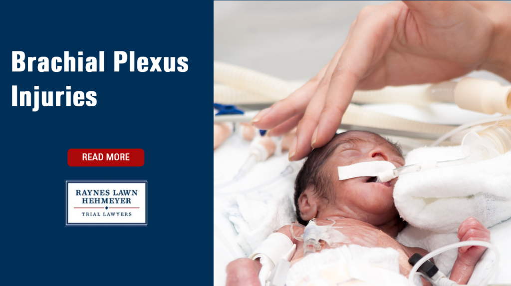 Brachial Plexus Injuries