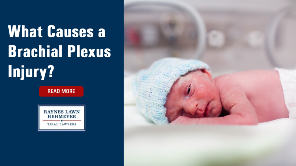 What Causes a Brachial Plexus Injury?