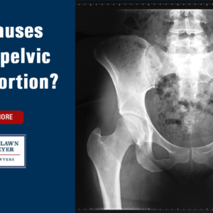 What Causes Cephalopelvic Disproportion?