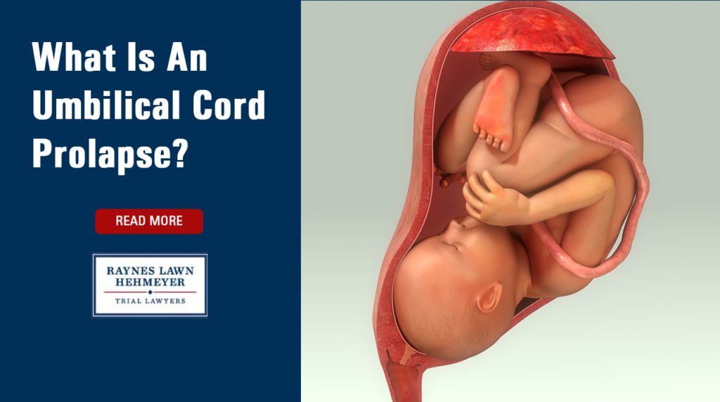 what-is-an-umbilical-cord-prolapse-raynes-lawn