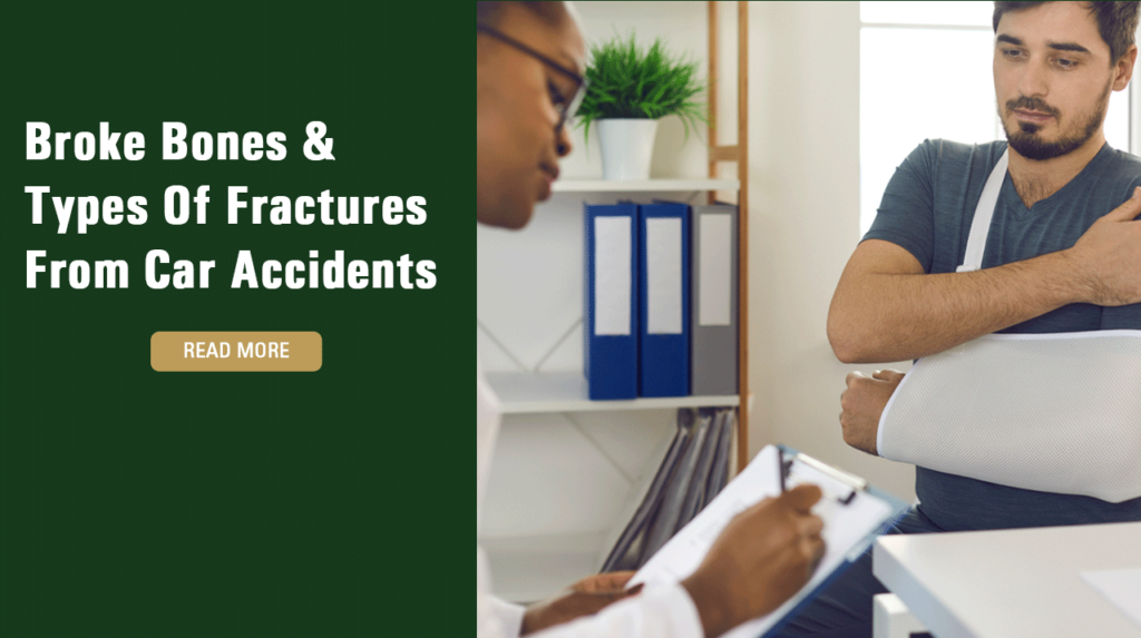 Broke Bones & Types Of Fractures From Car Accidents  