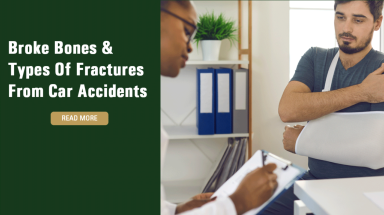 Broke Bones & Types Of Fractures From Car Accidents