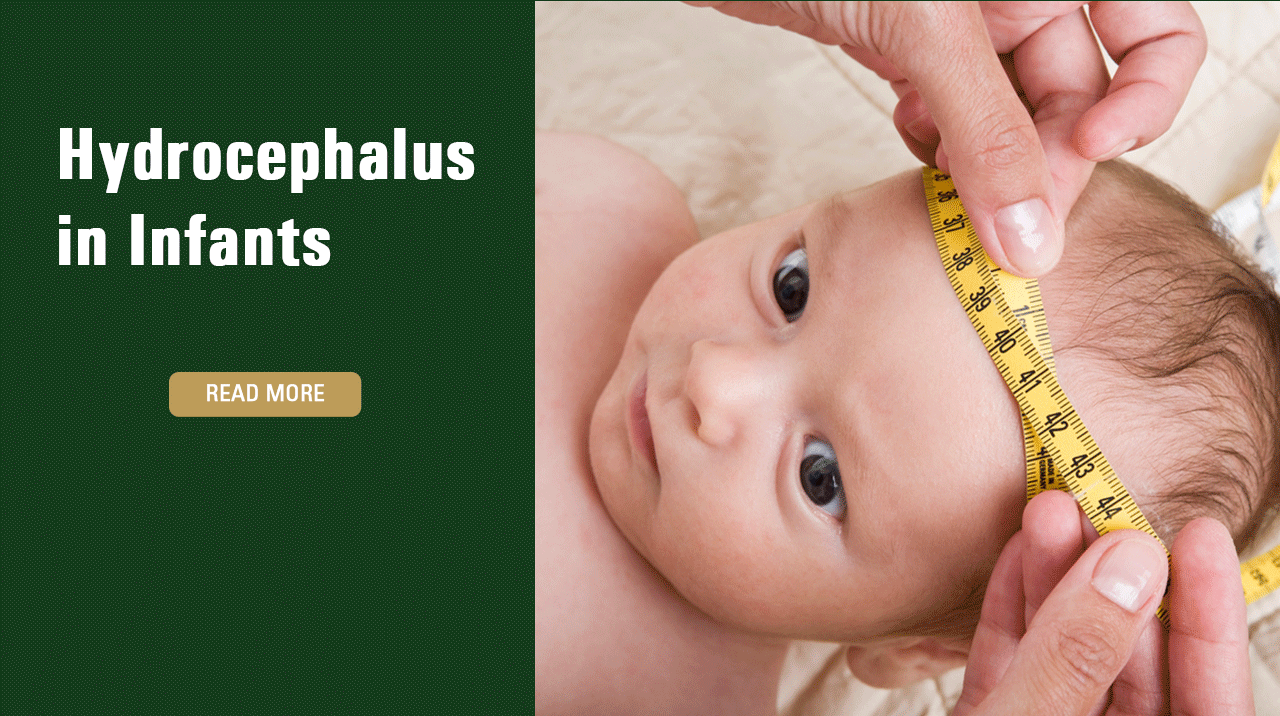 Hydrocephalus in Infants