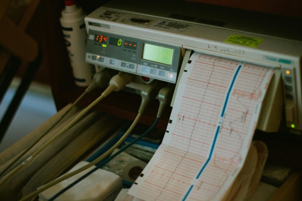 Category II fetal tracings on a strip of paper