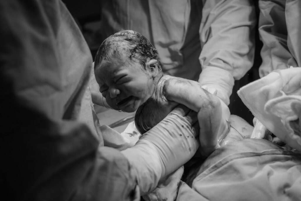 Delayed neonatal resuscitation can lead to many medical issues for the child in the future. If it could have been prevented, litigation may be necessary.