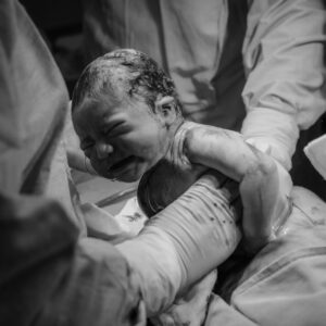 Delayed neonatal resuscitation can lead to many medical issues for the child in the future. If it could have been prevented, litigation may be necessary.