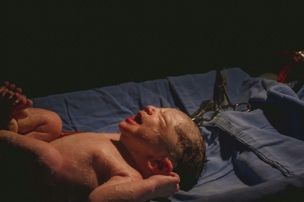 A newborn on a table. In some cases, it is important to identify the difference between hemorrhagic and ischemic injuries.