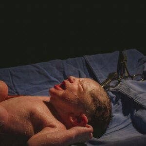 A newborn on a table. In some cases, it is important to identify the difference between hemorrhagic and ischemic injuries.