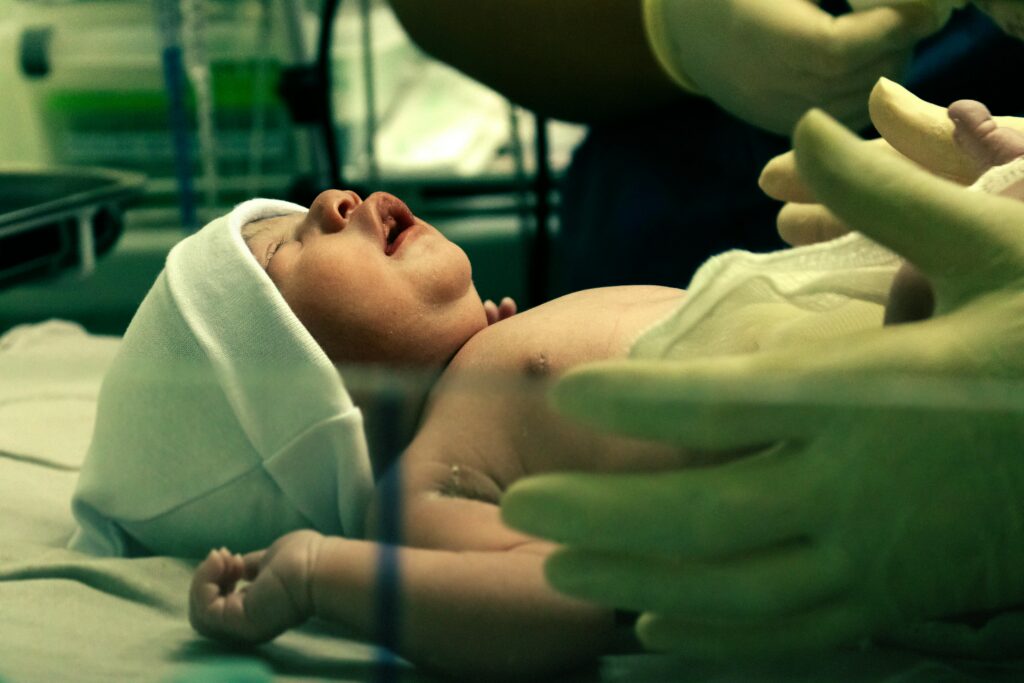A newborn delivered by operative means. Vacuum or forceps deliveries are less common and present some risk, which is why they are considered interventions.