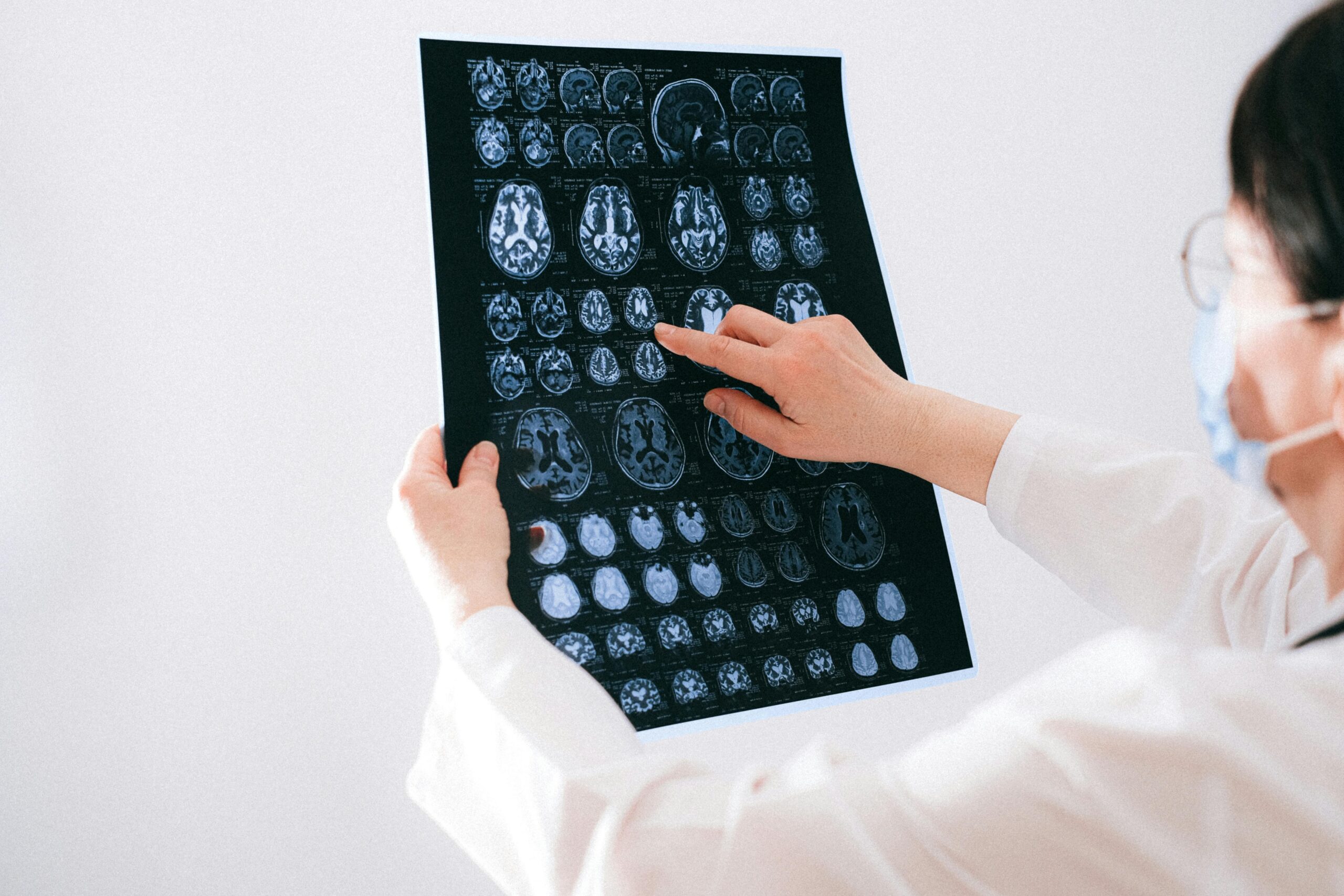 A female doctor looking at scans of a brain. Doctors can often tell the difference between hypoxic brain injury and a TBI and may be called to testify in court.