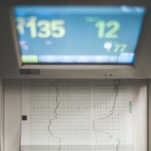 A shot of fetal heart tracings.