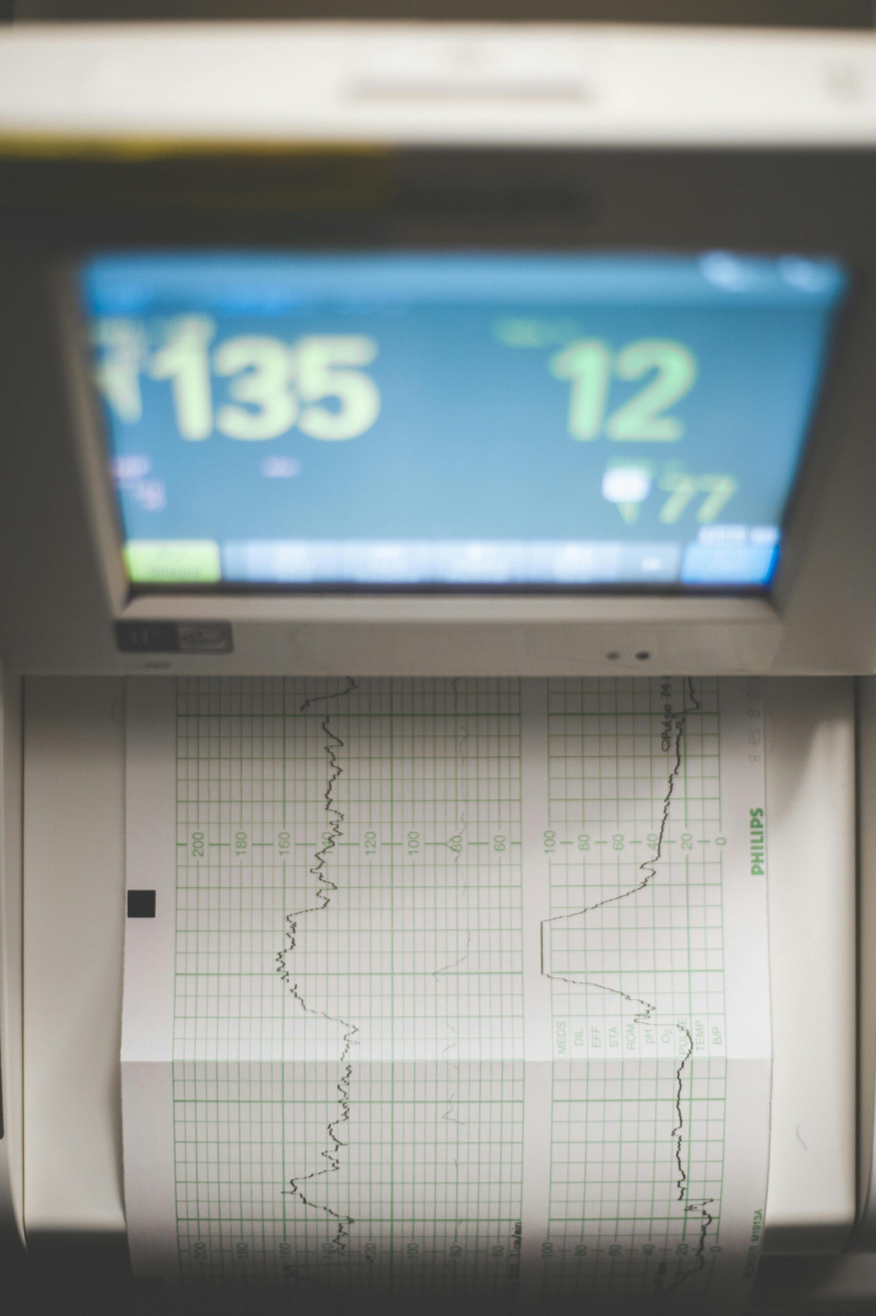 A shot of fetal heart tracings.