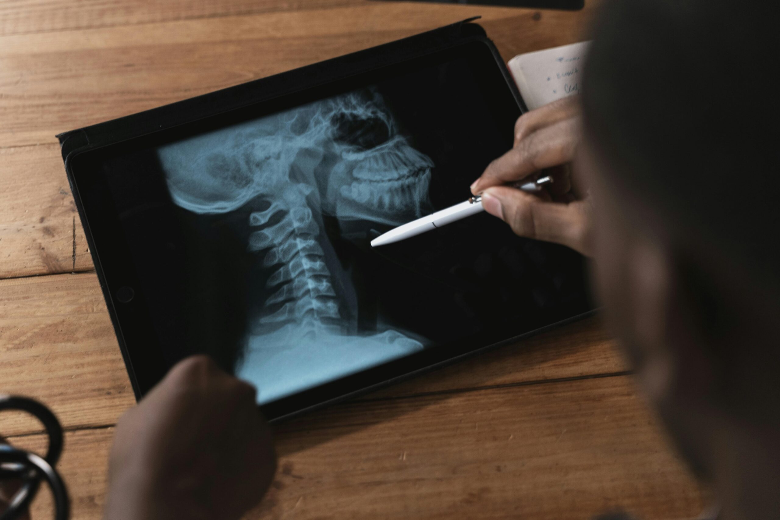 X-ray of the cervical spine. In a trial, such images become central to the case.