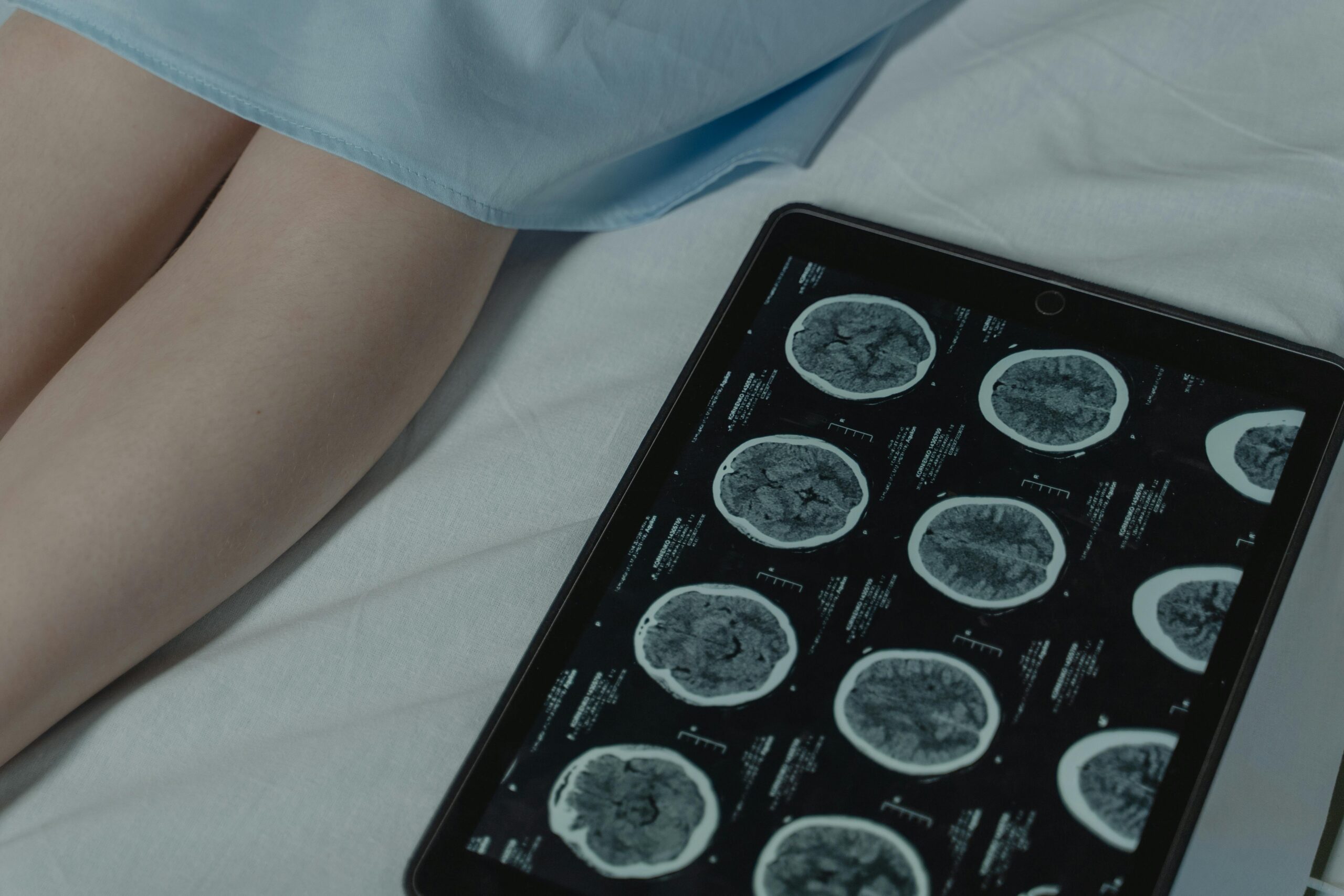A series of brain scans on a tablet next to a patient in a hospital bed. In cases of mild traumatic brain injury, what looks mild in a scan may still have detrimental effects.