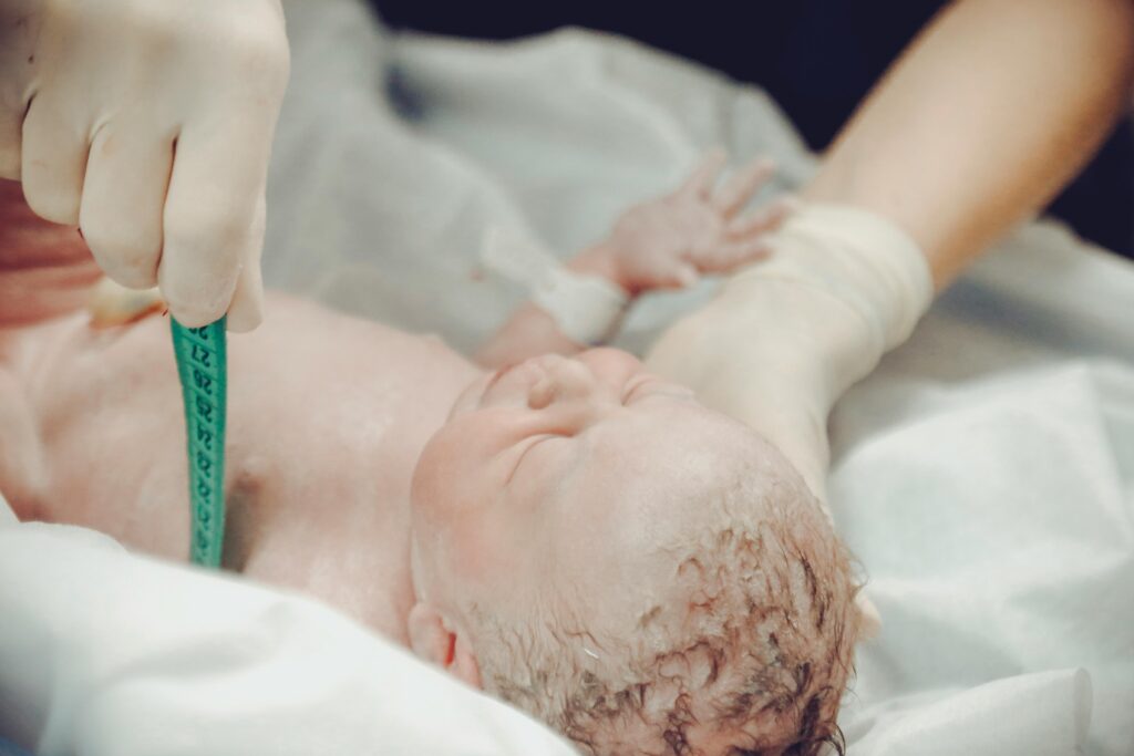 A newborn being given medical care after being born with shoulder dystocia.