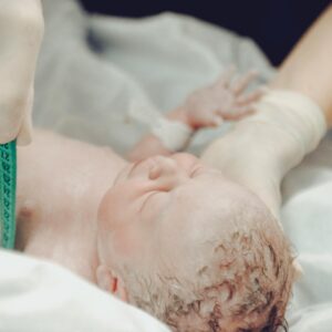 A newborn being given medical care after being born with shoulder dystocia.