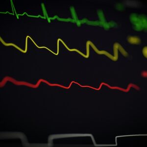 Inconsistent vital sign monitoring may mean that certain warnings were overlooked or went unnoticed, leading to potential injuries.