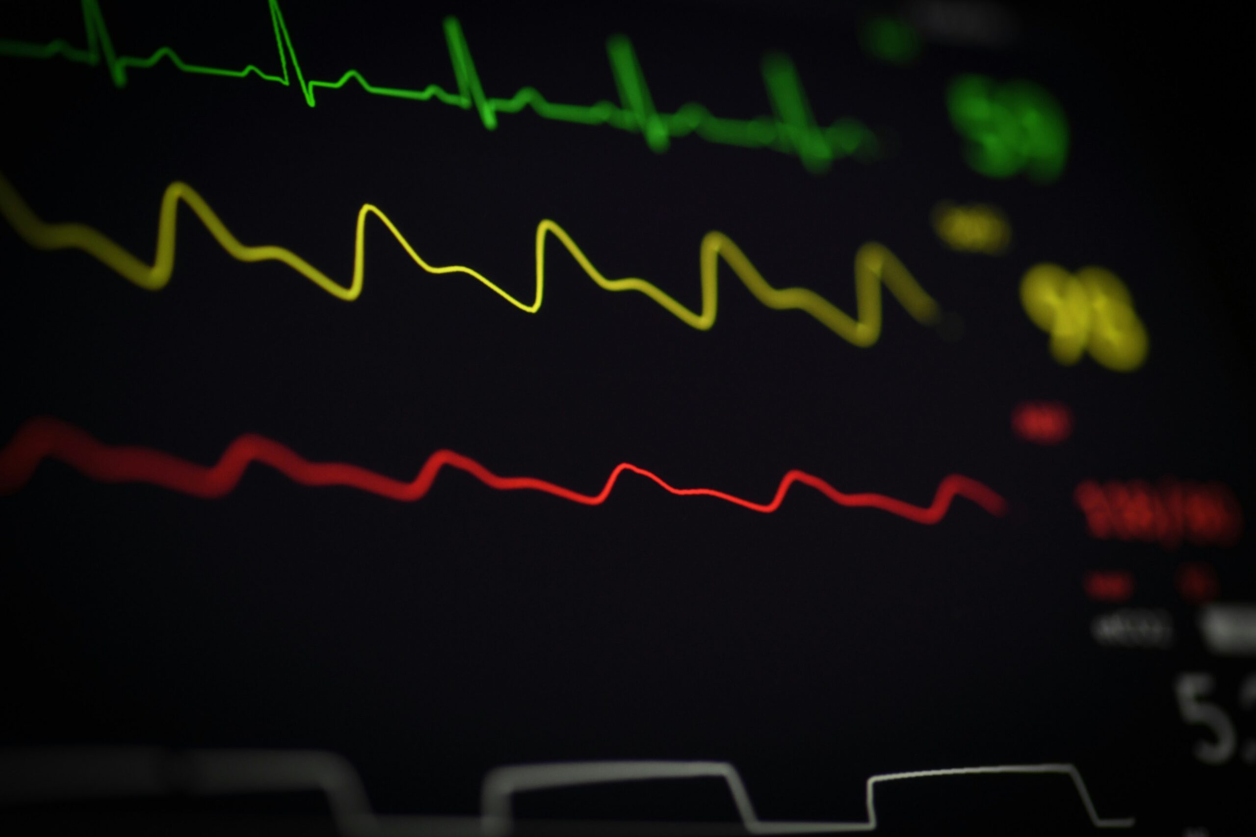 Inconsistent vital sign monitoring may mean that certain warnings were overlooked or went unnoticed, leading to potential injuries.