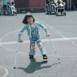 A child using leg braces and crutches to move. Video of her movement may be used as day-in-the-life evidence should her case make it to court.