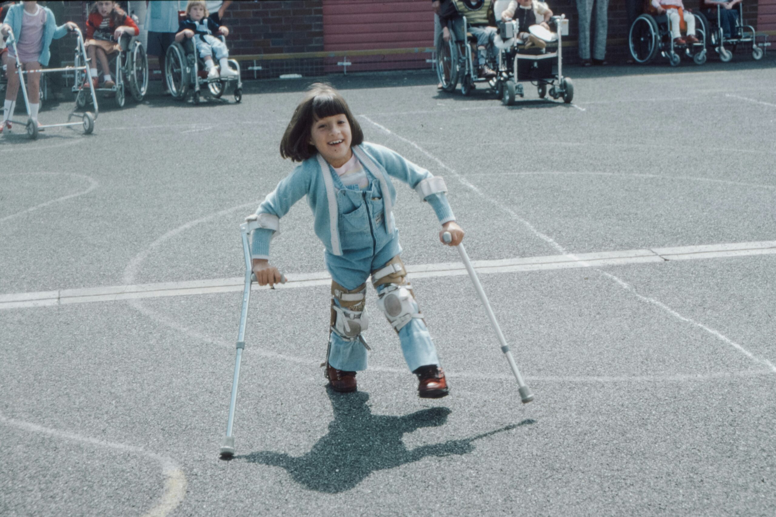 A child using leg braces and crutches to move. Video of her movement may be used as day-in-the-life evidence should her case make it to court.