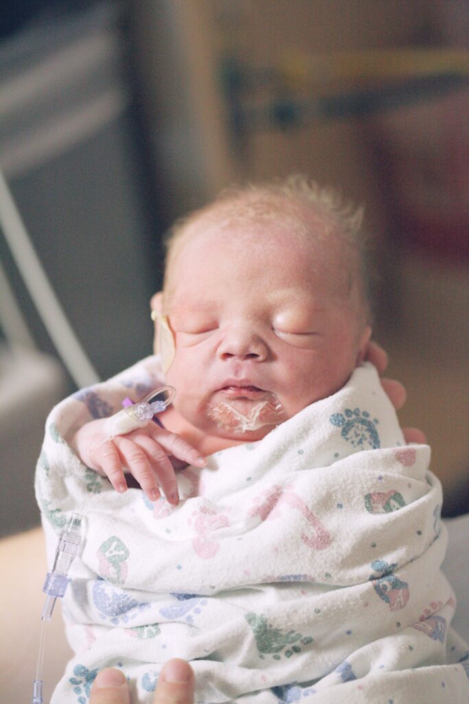 A newborn baby swaddled. Neonatal encephalopathy is a serious condition that could leave a newborn severely disabled. It must be diagnosed promptly.