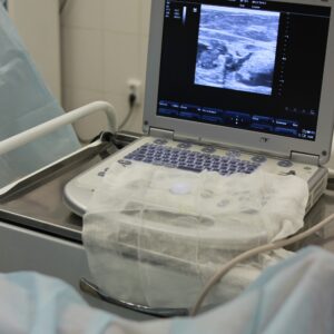 An ultrasound looking at a fetus in the womb. It is during this routine checkups that placental inufficiency may be first spotted.