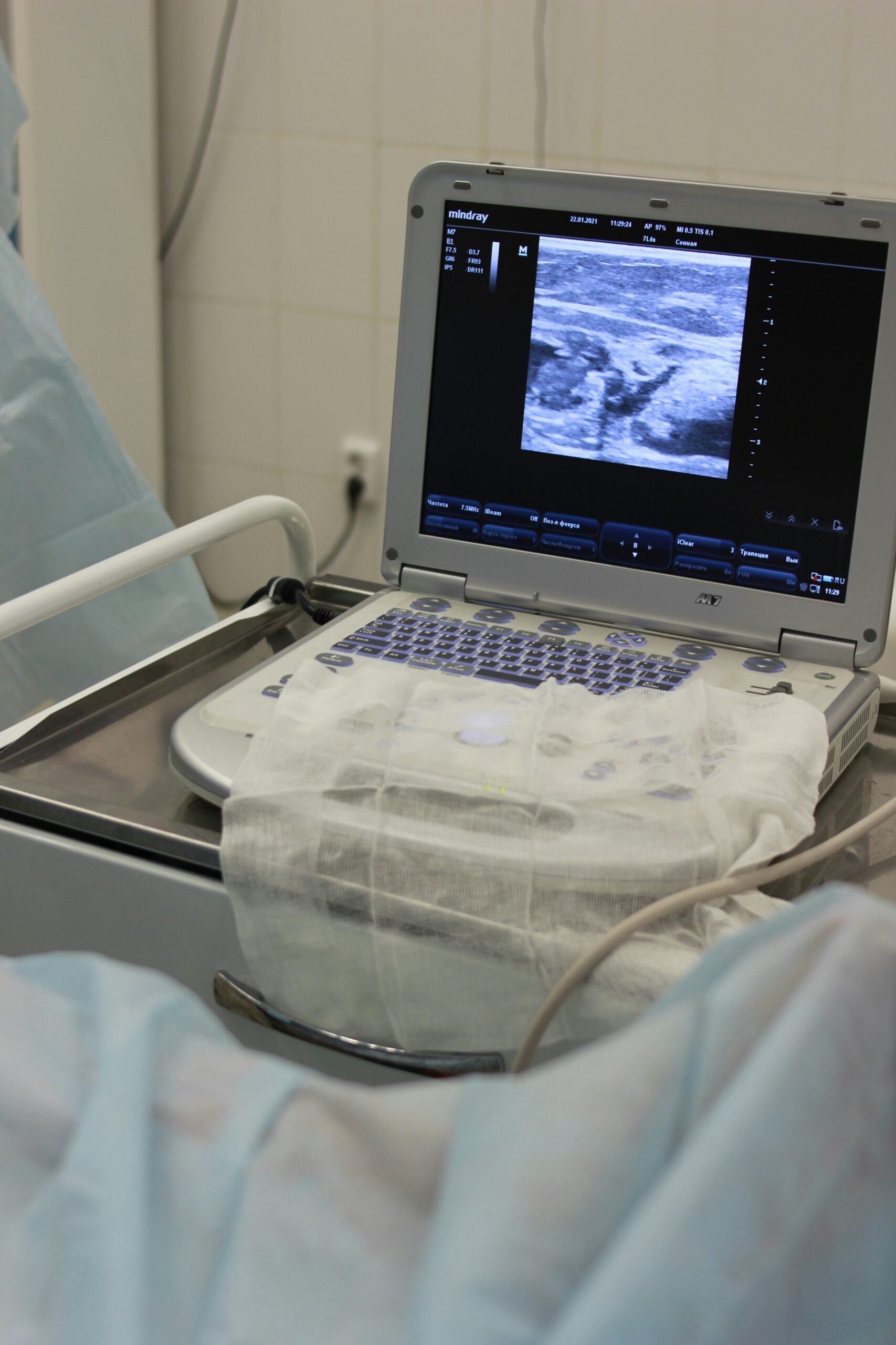An ultrasound looking at a fetus in the womb. It is during this routine checkups that placental inufficiency may be first spotted.